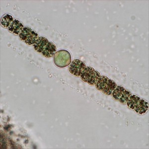 http://www.regito.com/webshop1/27-80-thickbox/analys-av-vaxtplankton-kvalitativ.jpg