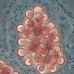 Mikrobiologiska unders&ouml;kningar